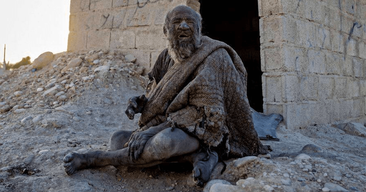 Man Who Didn’t Bathe For 60 Years Dies Months After Taking A Bath