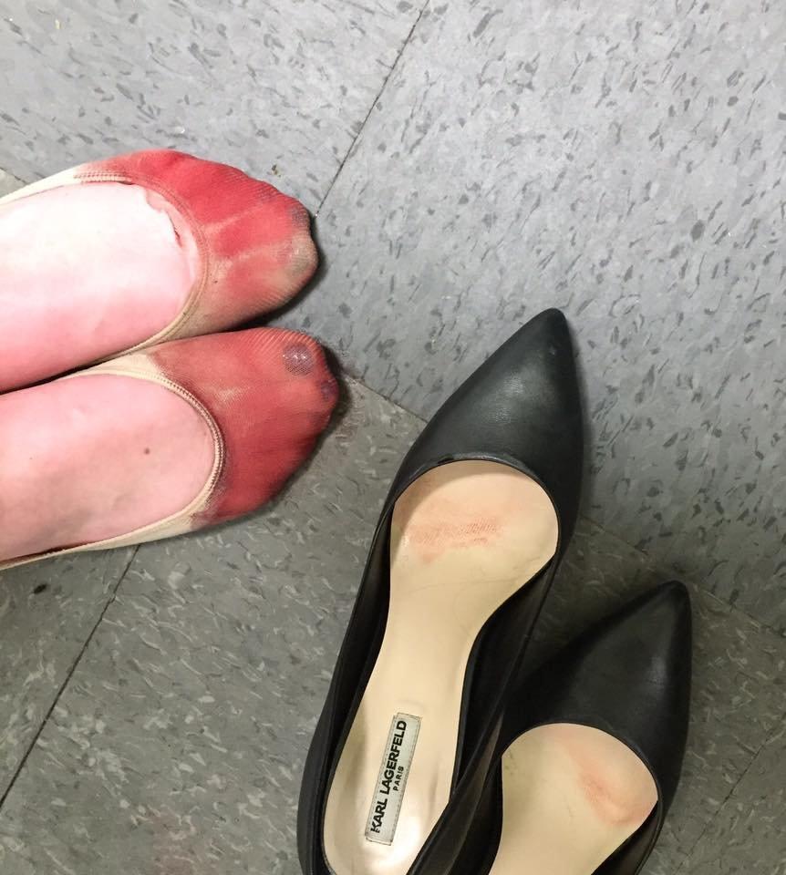 Waitress Shares Pics Of Bleeding Feet, After She Was Forced To Wear Heels While Working