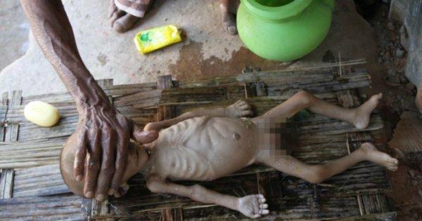 These Pictures Of A 6-Month-Old Baby Dying Of Starvation Show The Cruelty Refugees Face Every Day