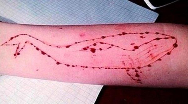 Jodhpur Girl Who Attempted Suicide To Complete Blue Whale Challenge Tries To Kill Herself Again