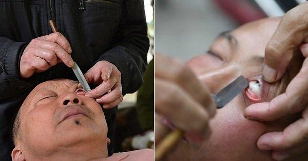 This Barber In China Shaves & Cleans Eyeballs To Improve People’s Vision