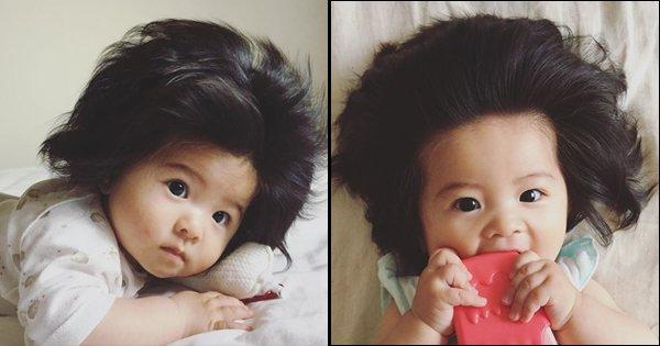 A Rare Medical Condition Made This Baby Born With A Full Head Of Hair An Internet Sensation