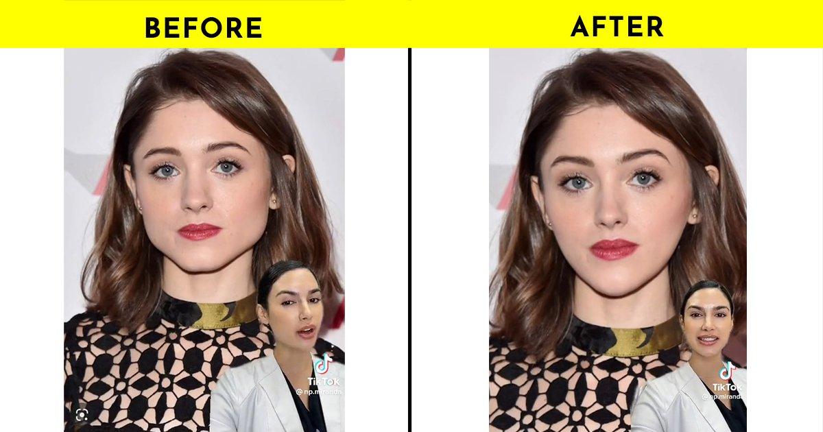 A Surgeon On TikTok Photoshopped Stranger Things’ Natalia Dyer’s Face As How It ‘Should’ Be. WTF?