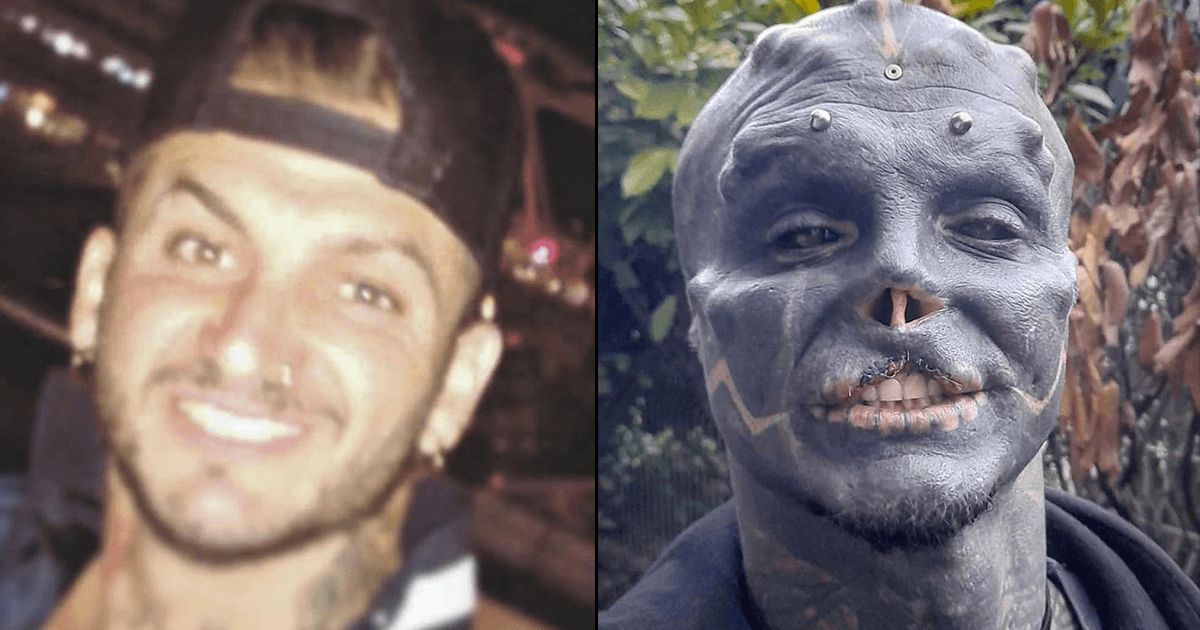 Before & After Photo Of This Guy Who’s Surgically Morphed Into An Alien Has Shocked Netizens