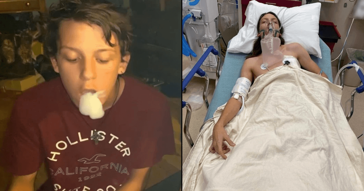 Vaping Collapsed A Teen’s Lungs 4 Times: His Insides ‘Look Like He Has Smoked For 30 Years’
