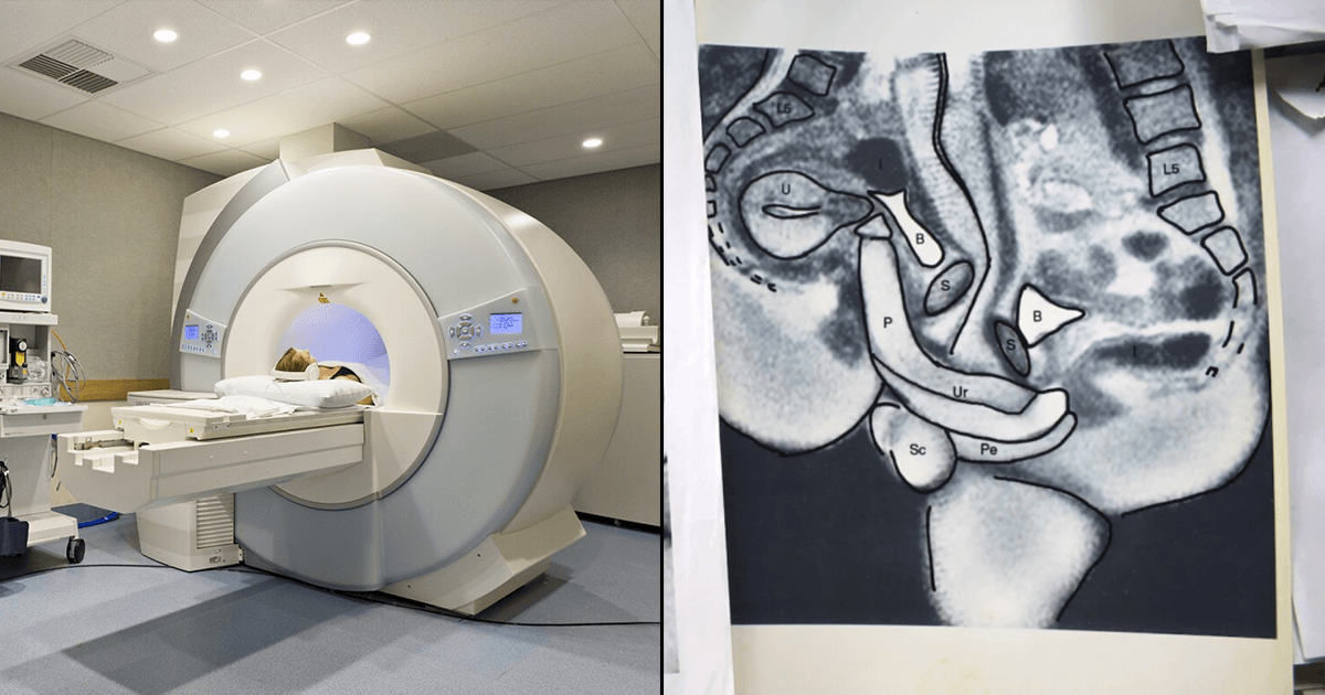 A Couple Had Sex In An MRI Machine, All For Science