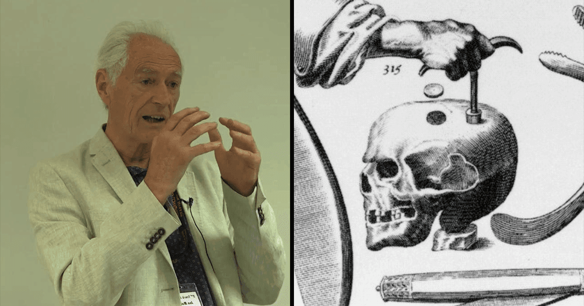 Man Drilled A Hole In His Skull To Get Permanently High & We Can’t Wrap Our Heads Around It